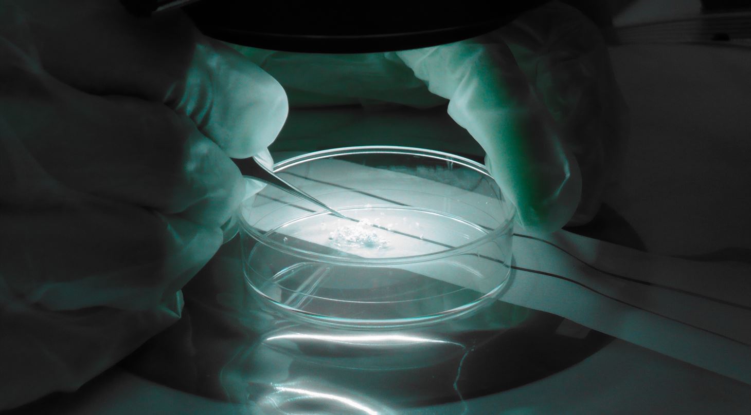 Analysis of foreign matter
